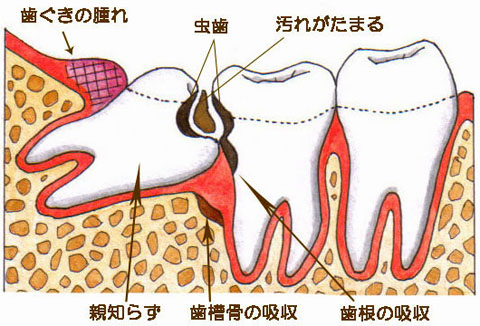 お知らせ 医療法人evidens 保険 自費問わず高度な歯科医療を